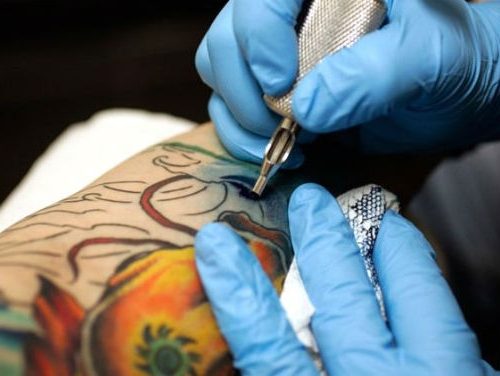 Types of Tattoo Removal Methods - Goose Tattoo