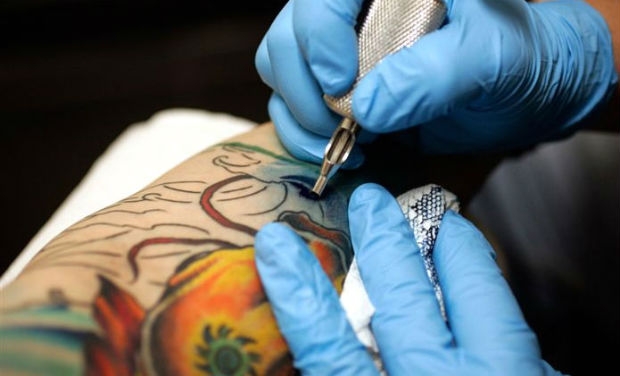 Types of Tattoo Removal Methods - Goose Tattoo